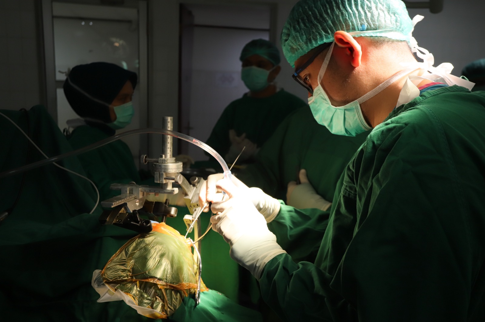 Perdana, RS Adam Malik Sukes Lakukan Operasi Stereotaktik Tumor Biopsi