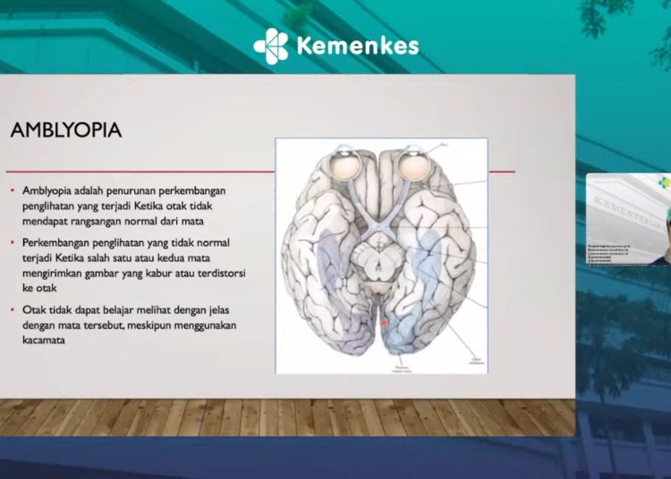 Jaga Kesehatan Mata Anak: Cegah Kebutaan di Masa Depan