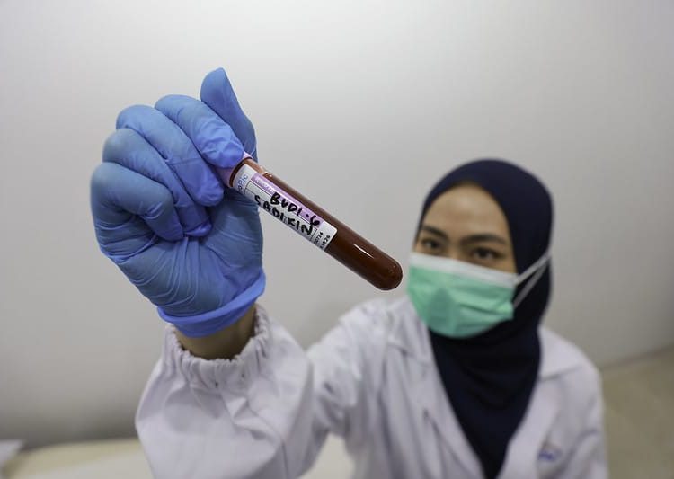 Percepat Kemandirian Obat, Kemenkes Luncurkan 3 Langkah Produksi Bahan Baku Dalam Negeri
