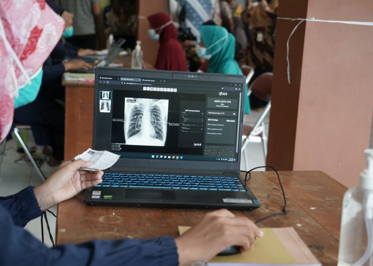 Penularan TBC Perlu Waspadai, Investigasi Kontak Jadi Kunci Pencegahan
