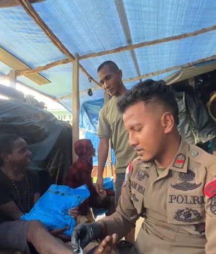 Anak Terluka di Intan Jaya Mendapat Pengobatan Personel Ops Damai Cartenz 2025