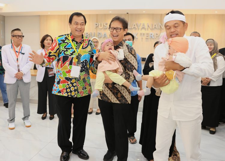 RSUP Dr Hasan Sadikin Berhasil Pisahkan Bayi Kembar Siam Nadia dan Nadira
