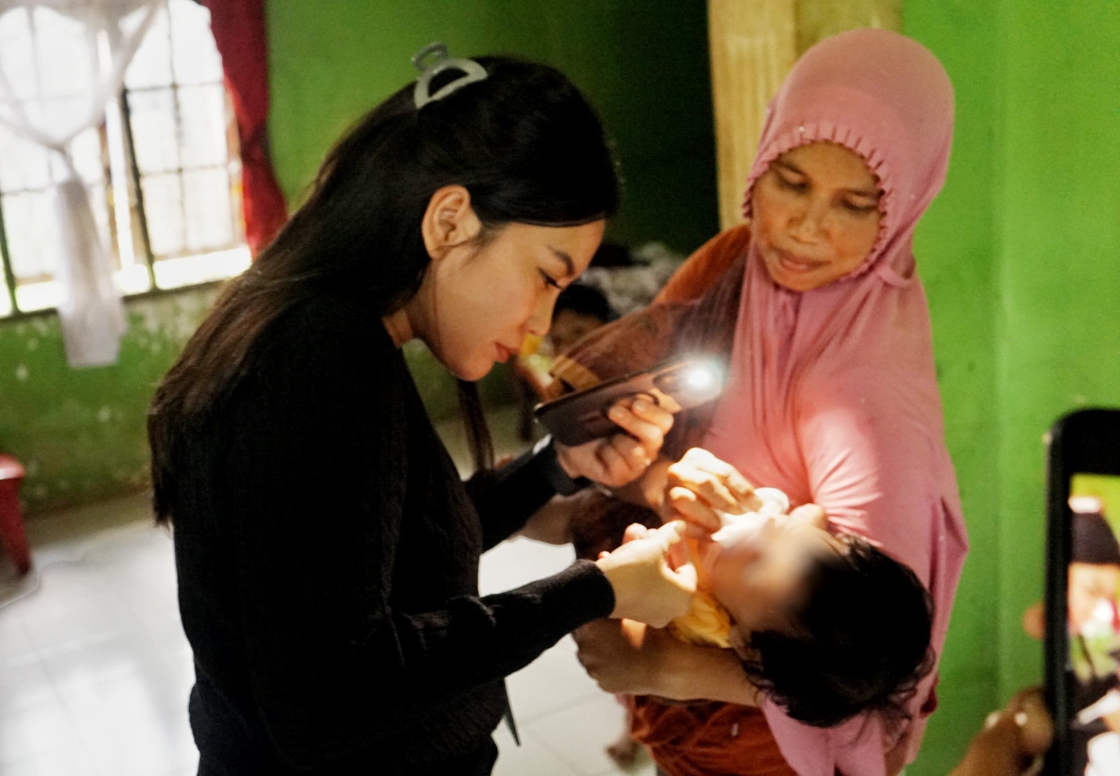 Wali Kota Medan Kembalikan Senyum Manis Salwa Pasca Operasi Sumbing Langit-Langit